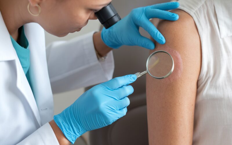 Telemedicina dermatológica: a revolução no diagnóstico precoce de lesões