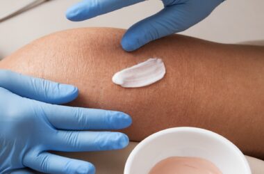 Entendendo Retinoides: O que São e Como Incorporá-los na sua Rotina