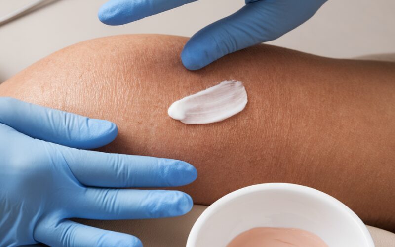 Entendendo Retinoides: O que São e Como Incorporá-los na sua Rotina