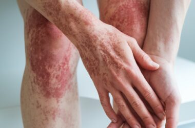 Proteção Diária: Como Adaptar seu Skincare às Mudanças Climáticas