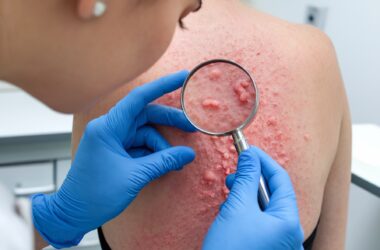 Terapias celulares avançadas: o futuro da cicatrização já é realidade