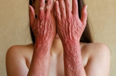 Medicina regenerativa cutânea: o avanço que está redefinindo cicatrizes