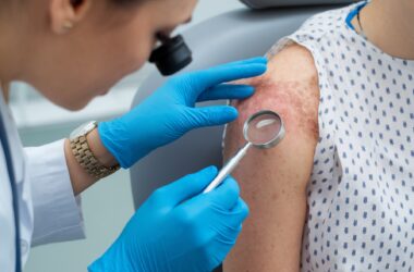 Medicina integrativa revoluciona tratamentos para pele sensibilizada