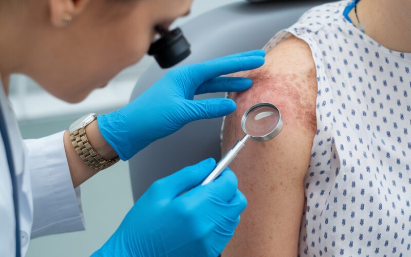 Medicina integrativa revoluciona tratamentos para pele sensibilizada