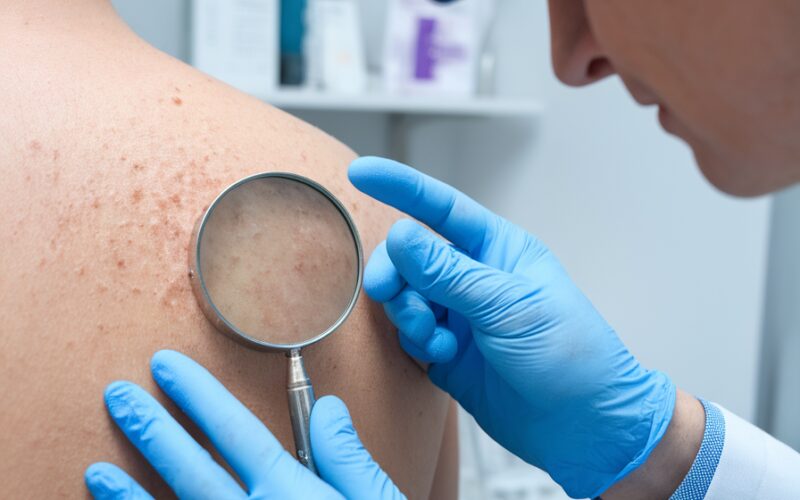 Dermatologia integrativa: quando a pele revela o que o corpo esconde