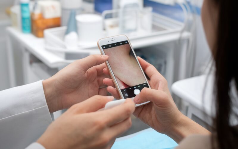 Inteligência artificial na dermatologia: diagnósticos precisos ao alcance da pele