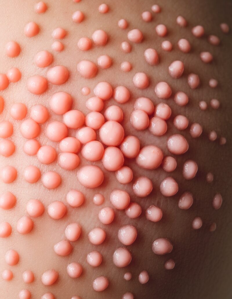 Por Dentro da Barreira Cutânea: Como Fortalecer a Proteção Natural da Pele