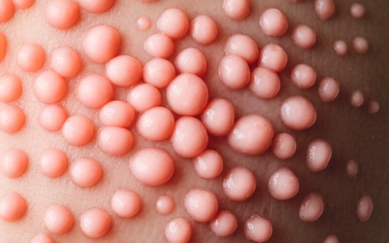 Por Dentro da Barreira Cutânea: Como Fortalecer a Proteção Natural da Pele