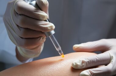 Terapias biológicas na dermatologia: o futuro no tratamento de doenças da pele