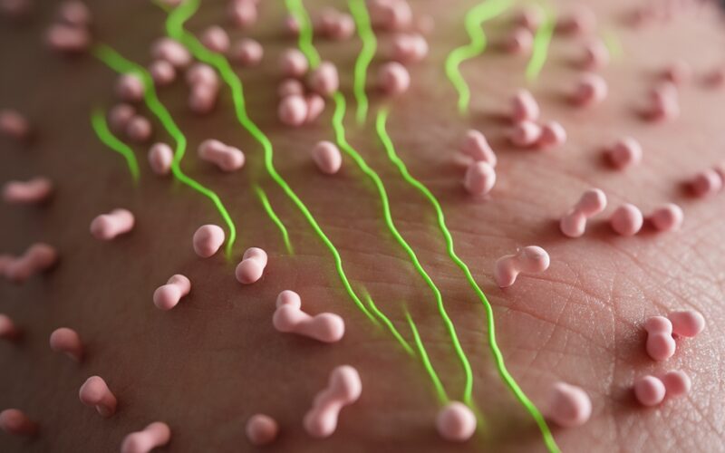 Minha dica escolhida é: Para acne e rosácea, recomenda-se uma combinação de cuidado com o microbioma, uso de agentes anti-inflamatórios suaves e hidratação balanceada, evitando formulações agressivas que possam desregular a microbiota natural da pele. Esta abordagem mais gentil respeita o equilíbrio natural da pele enquanto trata efetivamente essas condições inflamatórias comuns.