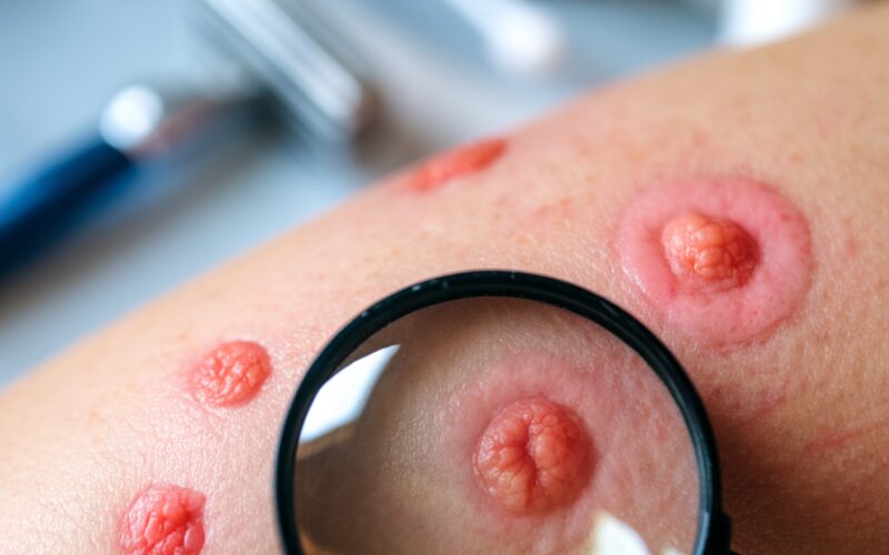 Baseado nas informações fornecidas, escolho destacar a seguinte dica: **Priorize a saúde do microbioma cutâneo** A ciência recente comprova que o equilíbrio do microbioma da pele é fundamental para prevenir condições inflamatórias e retardar o envelhecimento. Produtos com ingredientes prebióticos e probióticos específicos estão ganhando destaque por sua capacidade de fortalecer a barreira cutânea natural, melhorando a proteção e resiliência da pele contra agressões externas. Esta abordagem alinha-se perfeitamente com a tendência de tratamentos menos invasivos e mais sustentáveis que respeitam a biologia natural da pele.